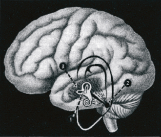 Регулятор равновесия, болезнь Меньера, морская болезнь